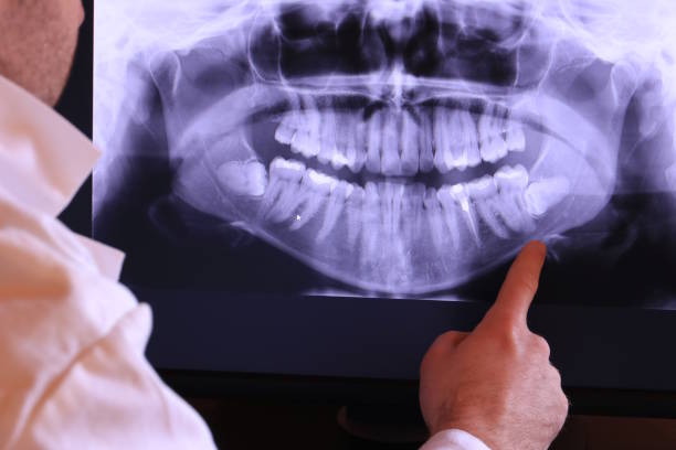 Best Dentist for Tooth Abscess  in Palmer Lake, CO