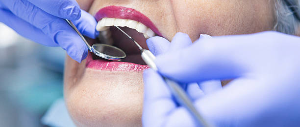 Best Emergency Tooth Extraction  in Palmer Lake, CO